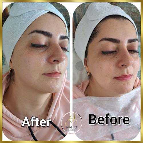 گالری پاکسازی پوست